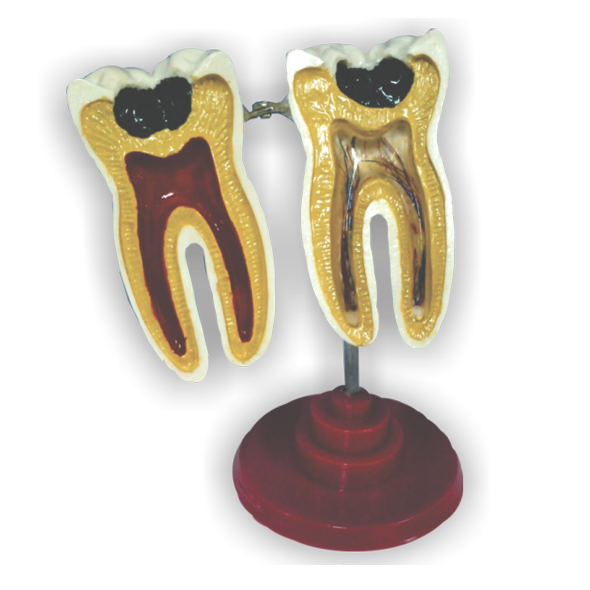 Molar corte Longitudinal